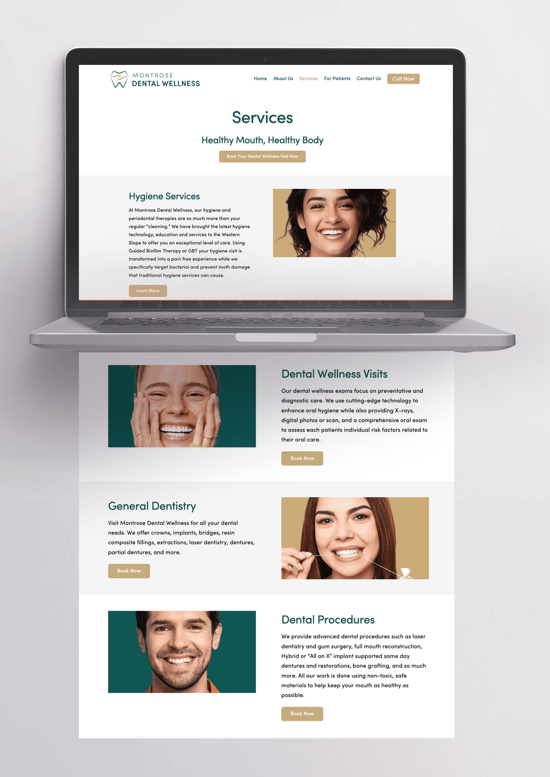 MDW Website Development Mock Up Montrose Dental Wellness_ Website Development Example_Services Page mock up